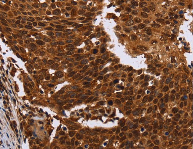 Polyclonal Rabbit anti-Human FANCF Antibody (IHC)