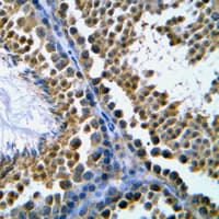 TOP2B / Topoisomerase II Beta Antibody (N-Terminus)