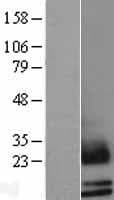 SCGB2A1 / Mammaglobin B Protein (Over-Expression Lysate Myc-DDK (Flag))