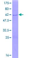 Human NMNAT1 / NMNAT Protein (Recombinant GST)