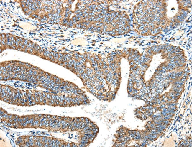 NDUFA5 Antibody