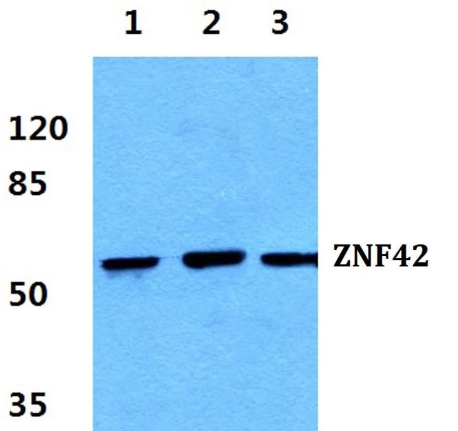 IHC-plus™ Polyclonal Rabbit anti-Human MZF / MZF1 Antibody (aa1-46, IHC, WB)