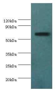 Polyclonal Rabbit anti-Human AMHR2 / MISRII Antibody (aa18-149, IHC, WB)