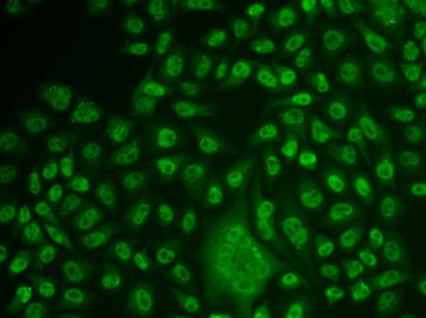 TFPT / Amida Antibody