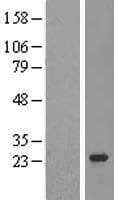 TRPT1 Protein (Over-Expression Lysate Myc-DDK (Flag))