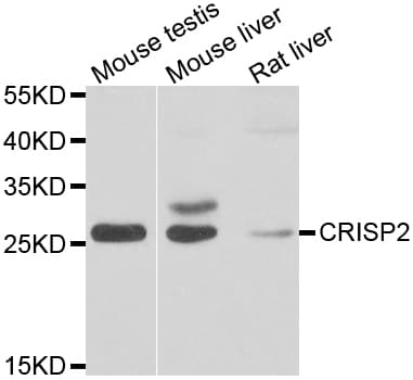 CRISP2 / TSP1 Antibody