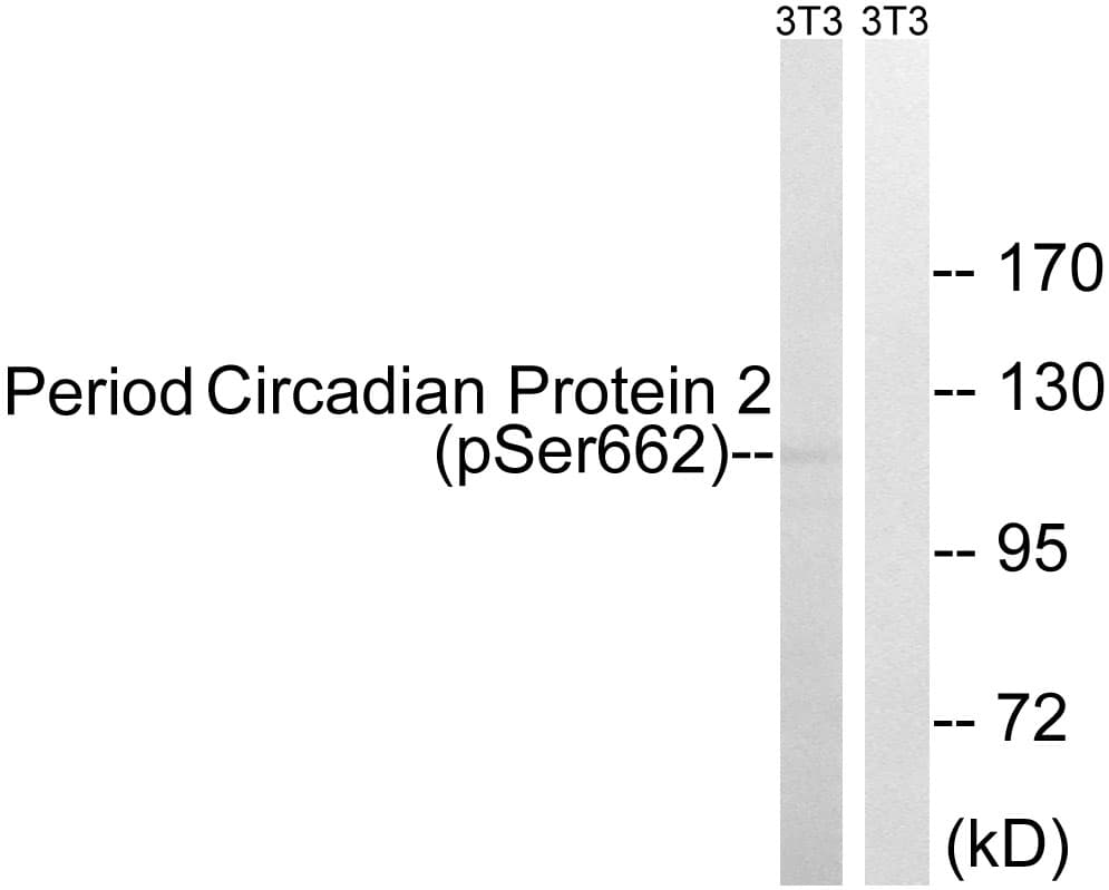 Polyclonal Rabbit anti-Human PER2 Antibody (phospho-Ser662, IHC, WB)