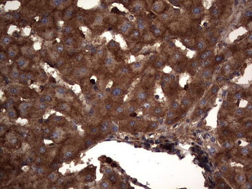 CEACAM5 / CD66e Antibody (aa35-680, clone OTI1C2)