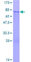 Human SUV39H1 Protein (Recombinant GST)