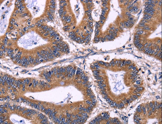 KIR2DL1+3+4 + KIR2DS4 Antibody