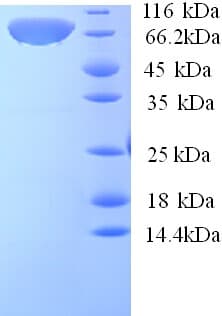 Human CAST / Calpastatin Protein (Recombinant His)