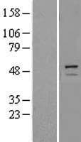 TRIM11 Protein (Over-Expression Lysate Myc-DDK (Flag))