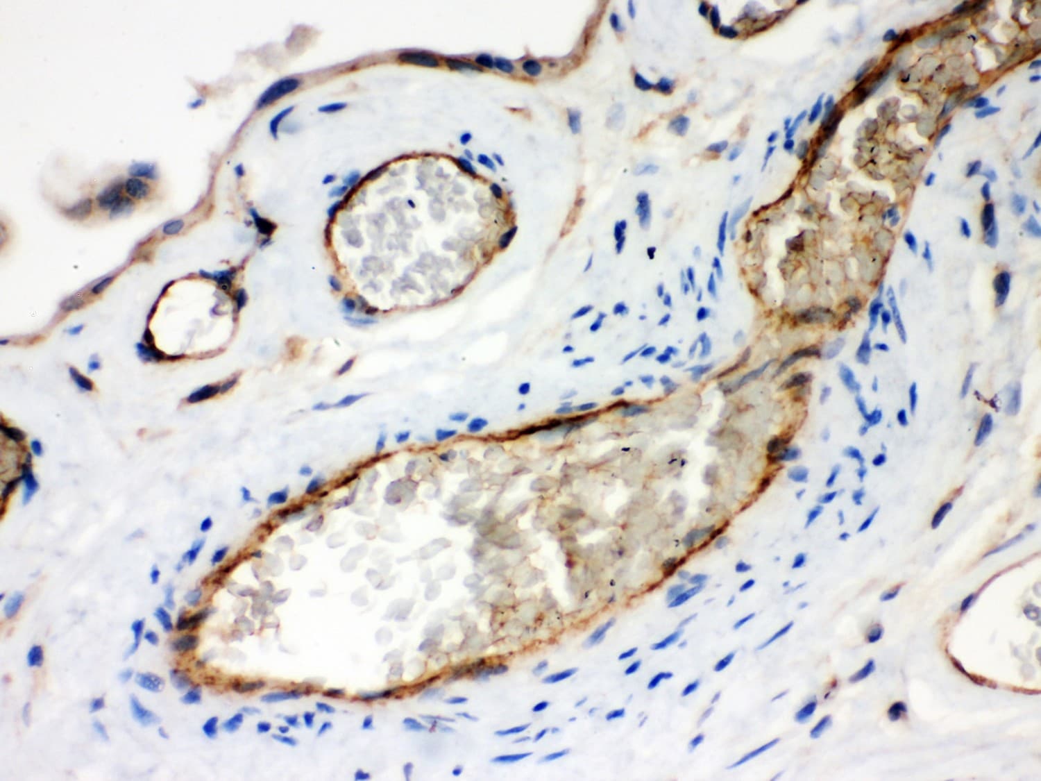 Polyclonal Rabbit anti-Human NRP1 / Neuropilin 1 Antibody (aa504-827, IHC, WB)