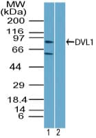 DVL1 / DVL / Dishevelled Antibody (aa70-120)