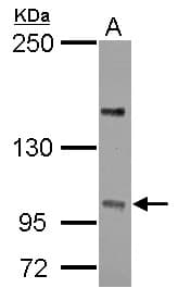 Polyclonal Rabbit anti-Human PPP4R4 Antibody (C-Terminus, WB)