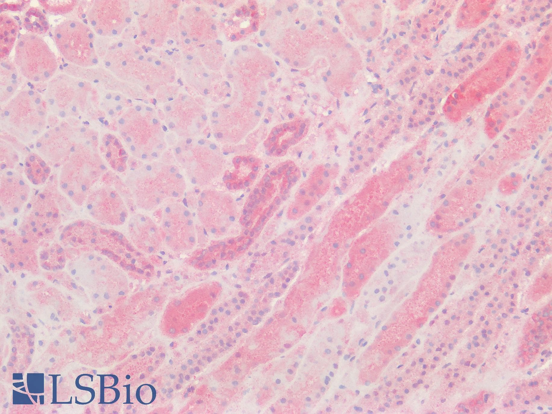IHC-plus™ GPRC5D Antibody (Cytoplasmic Domain)