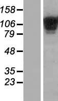 COL19A1 / Collagen XIX Protein (Over-Expression Lysate Myc-DDK (Flag))