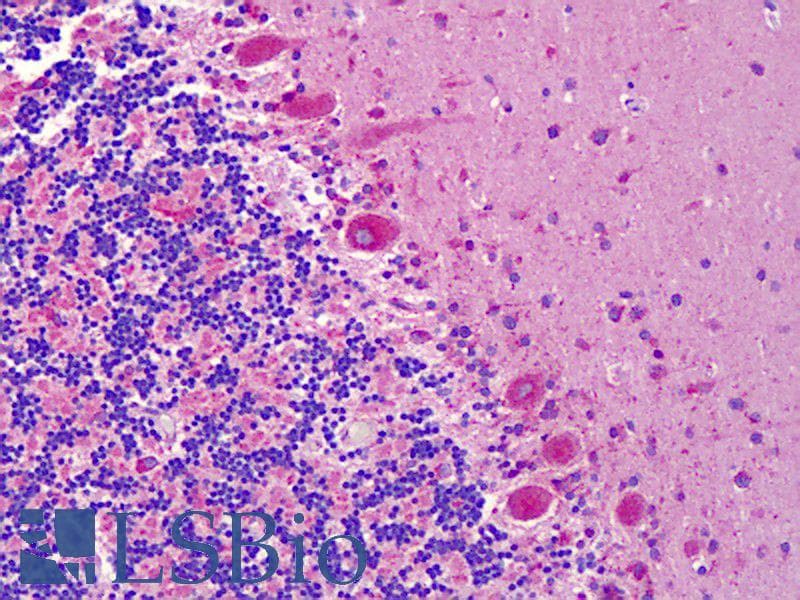 IHC-plus™ EPHA6 / EPH Receptor A6 Antibody (aa891-940)