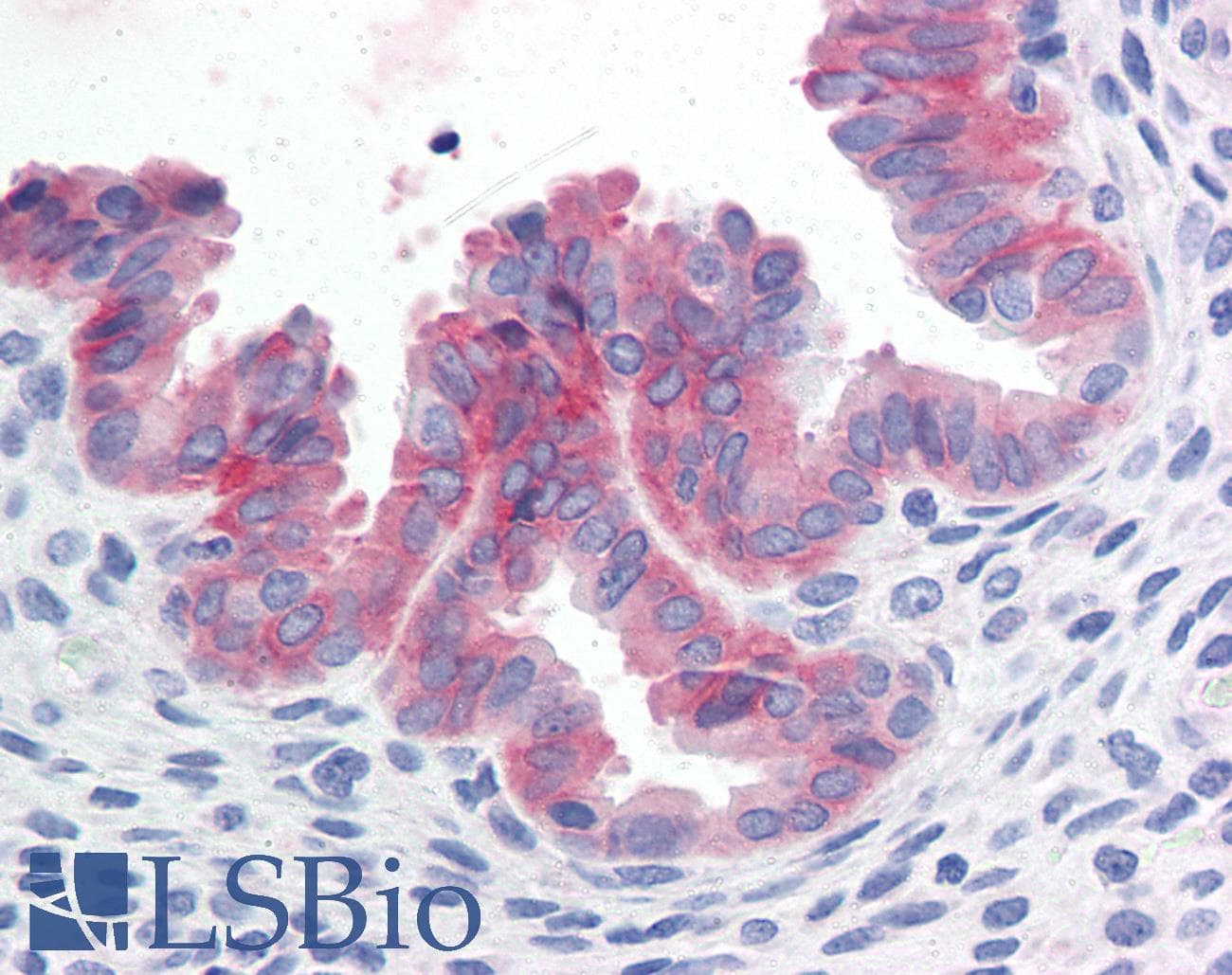 IHC-plus™ c-Met Antibody (Cytoplasmic Domain)