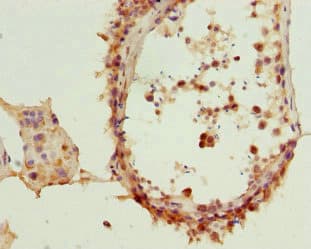 TCF19 / TCF-19 Antibody