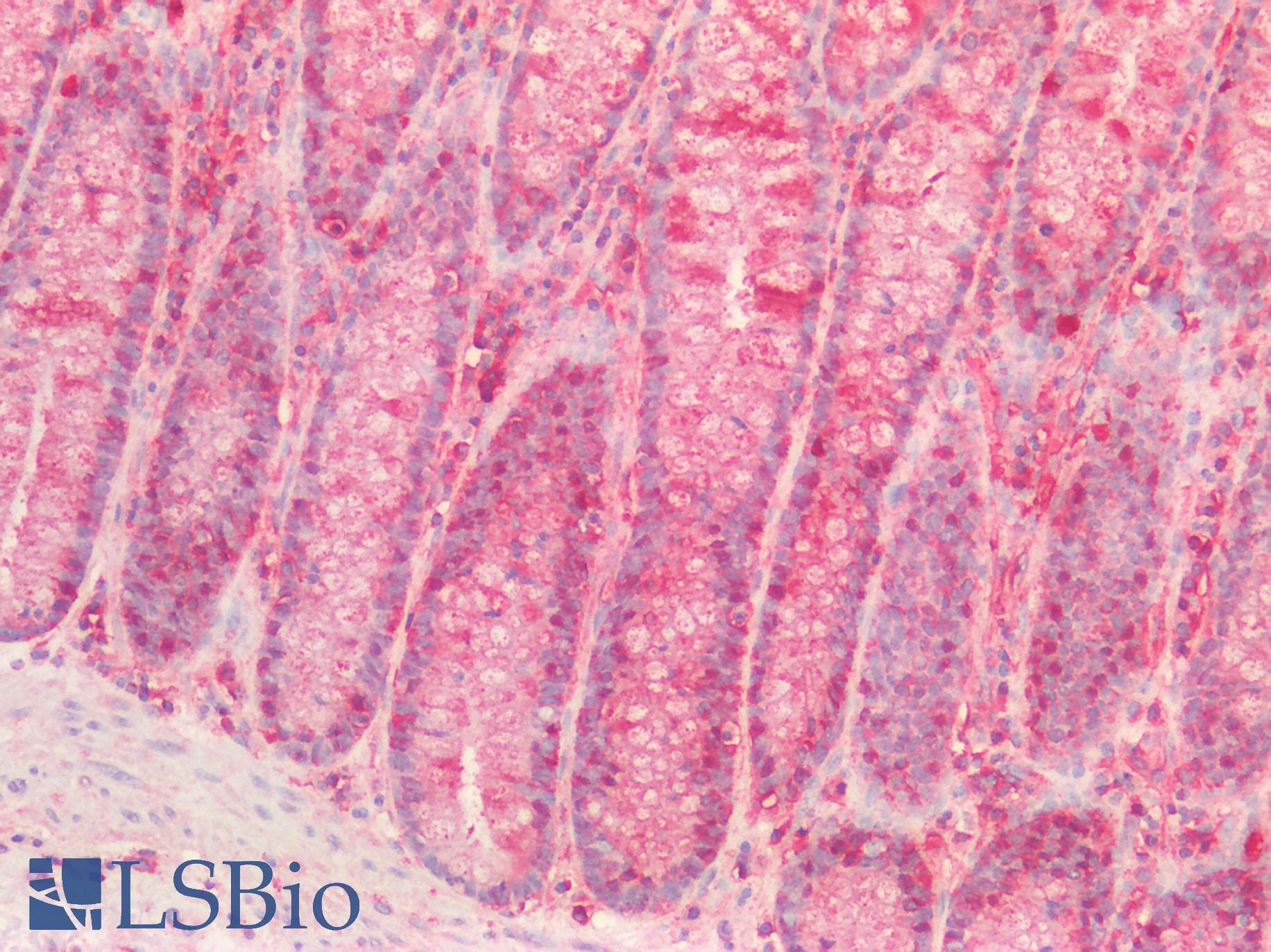 ROR2 Antibody