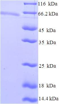 Human ZSCAN20 Protein (Recombinant His-SUMO)