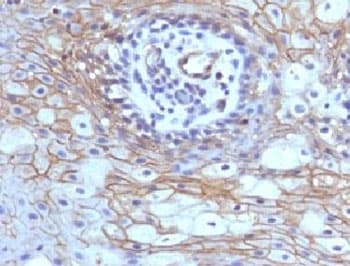 CD59 Antibody (clone MACIF/629)
