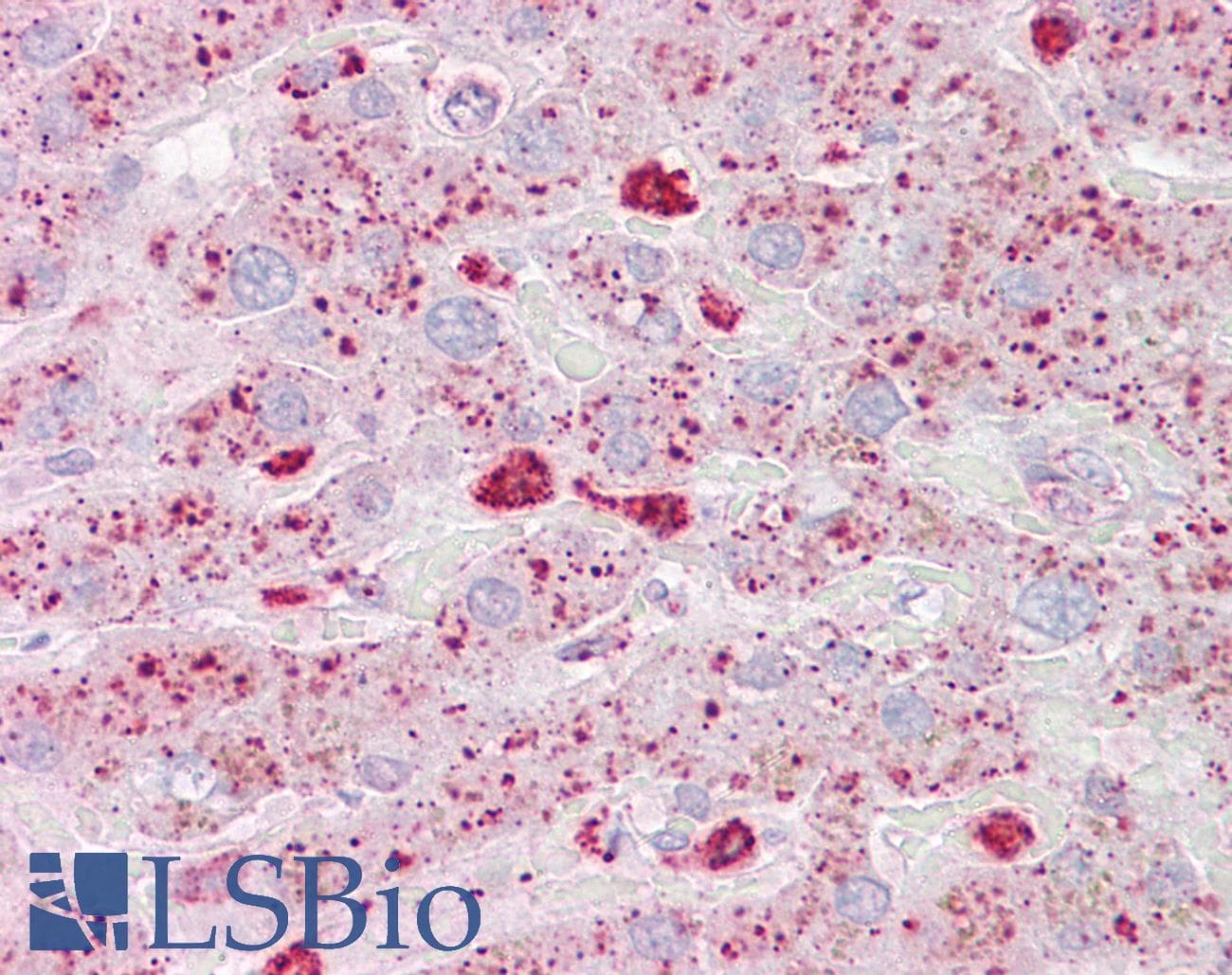 IHC-plus™ USP15 Antibody (aa970-981)