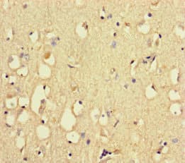 RYR2 / Ryanodine Receptor 2 Antibody