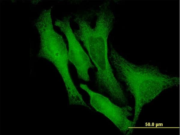 DCX / Doublecortin Antibody (clone 1G12)