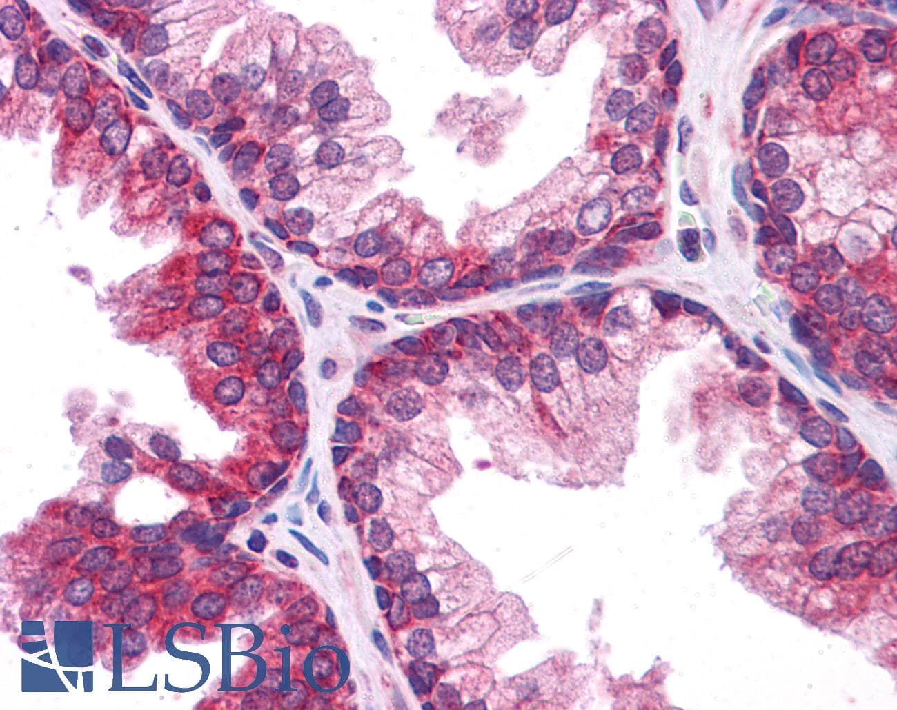 IHC-plus™ Polyclonal Rabbit anti-Human TMEM38B Antibody (IHC, IF, WB)