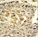 TJP1 / ZO-1 Antibody (aa1570-1600)