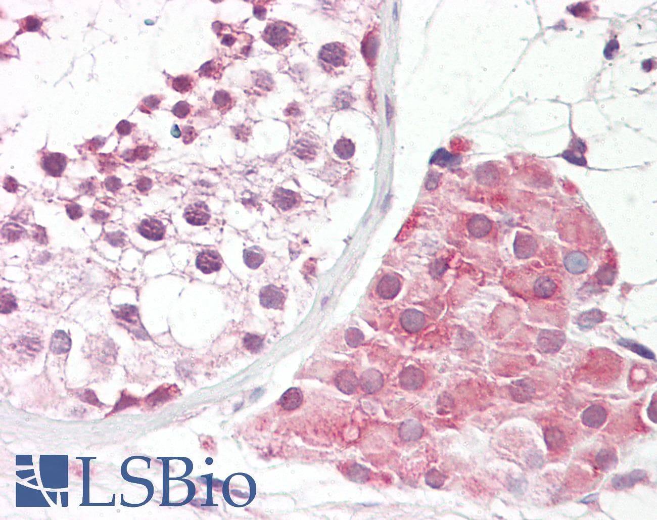 IHC-plus™ Polyclonal Rabbit anti-Human IKBKB / IKK2 / IKK Beta Antibody (aa166-215, IHC)