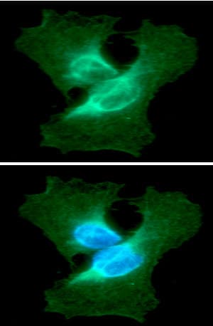 PathPlus™ Vimentin Antibody (clone AT5H8)