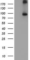 FGFR2 / FGF Receptor 2 Antibody (clone OTI5C5)