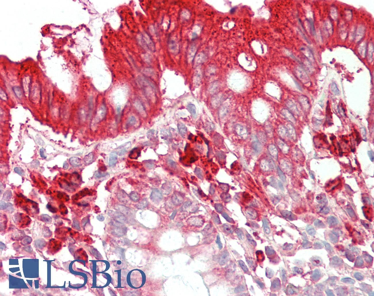 IHC-plus™ Polyclonal Goat anti-Human TFB2M Antibody (aa383-396, IHC)