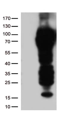 CD5 Antibody (clone UMAB9, Carrier-free)