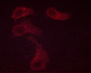BCL2 / Bcl-2 Antibody (phospho-Thr69)