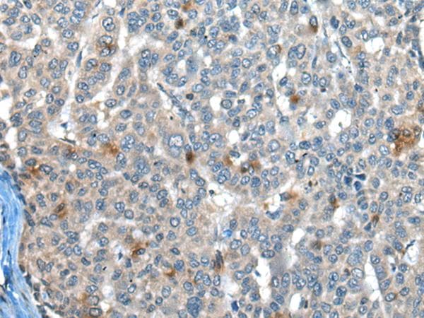 CAPN3 / Calpain 3 Antibody