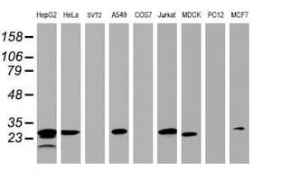 HSD17B8 / RING2 Antibody (aa57-261, clone OTI6H2, Carrier-free)