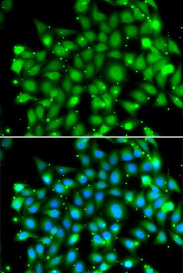 SUFU Antibody