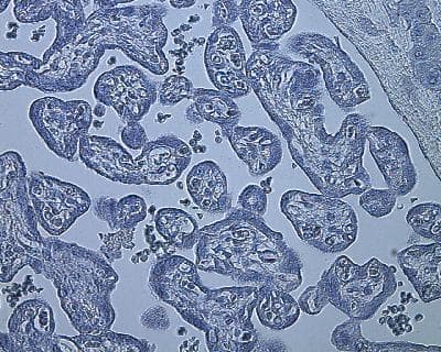 HIF1A / HIF1 Alpha Antibody (aa329-530, clone ESEE122, DY650)