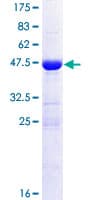 Human CRIP2 Protein (Recombinant GST)