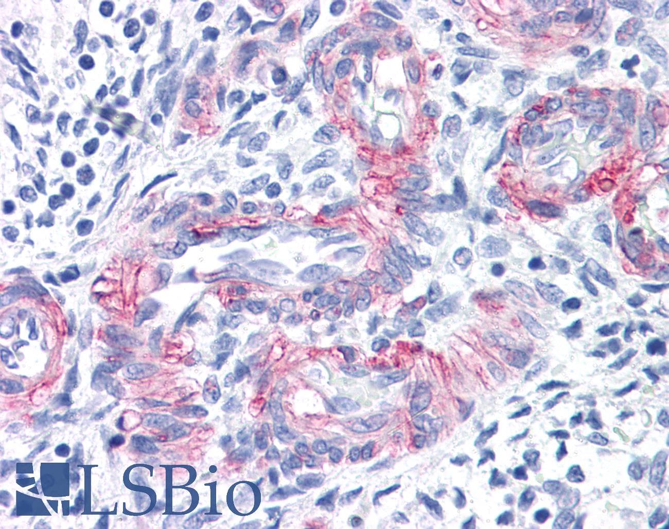 IHC-plus™ MCAM / CD146 Antibody (clone P1H12)