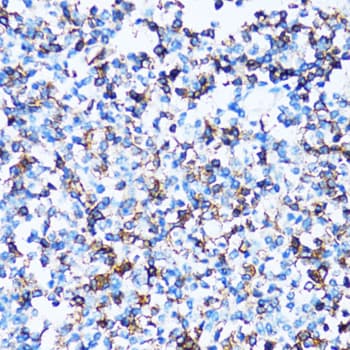 SPN / CD43 Antibody