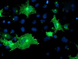 OSBP Antibody (clone OTI1F2)