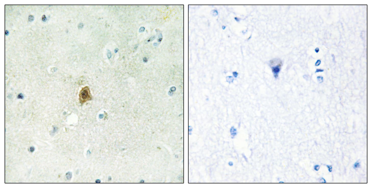 TAF15 Antibody (aa351-400)