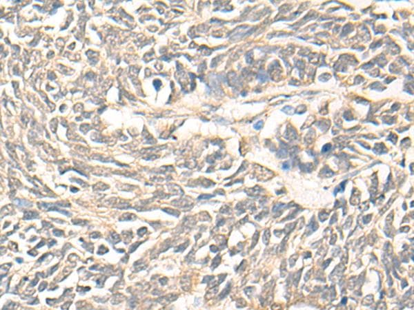 Polyclonal Rabbit anti-Human DMC1 Antibody (IHC)