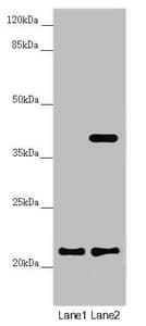 Polyclonal Rabbit anti-Human DCTN6 / Dynactin 6 Antibody (IHC, WB)