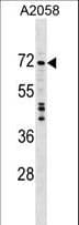 DDX56 Antibody (aa518-546)